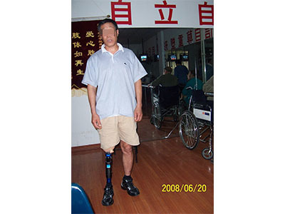 青島市遠(yuǎn)征假肢矯形器 專(zhuān)業(yè)假肢與矯形器的選擇與服務(wù)